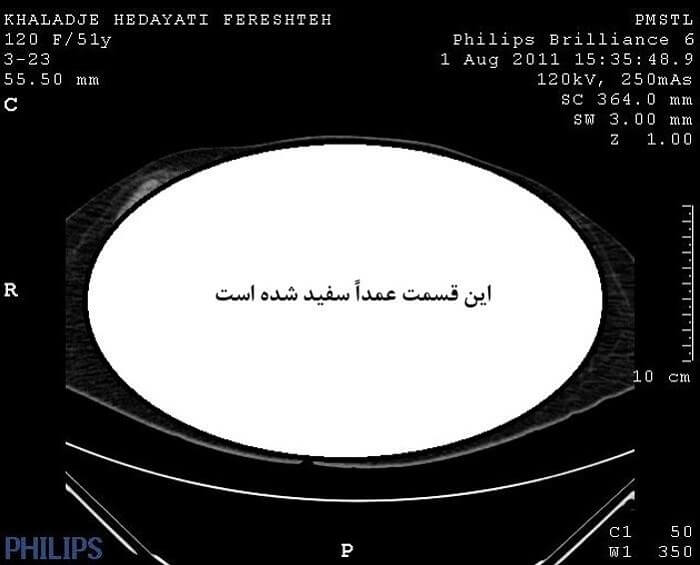 خدمتگزاری و مزدوری برای اطلاعات آخوندی