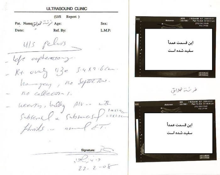 خدمتگزاری و مزدوری برای اطلاعات آخوندی