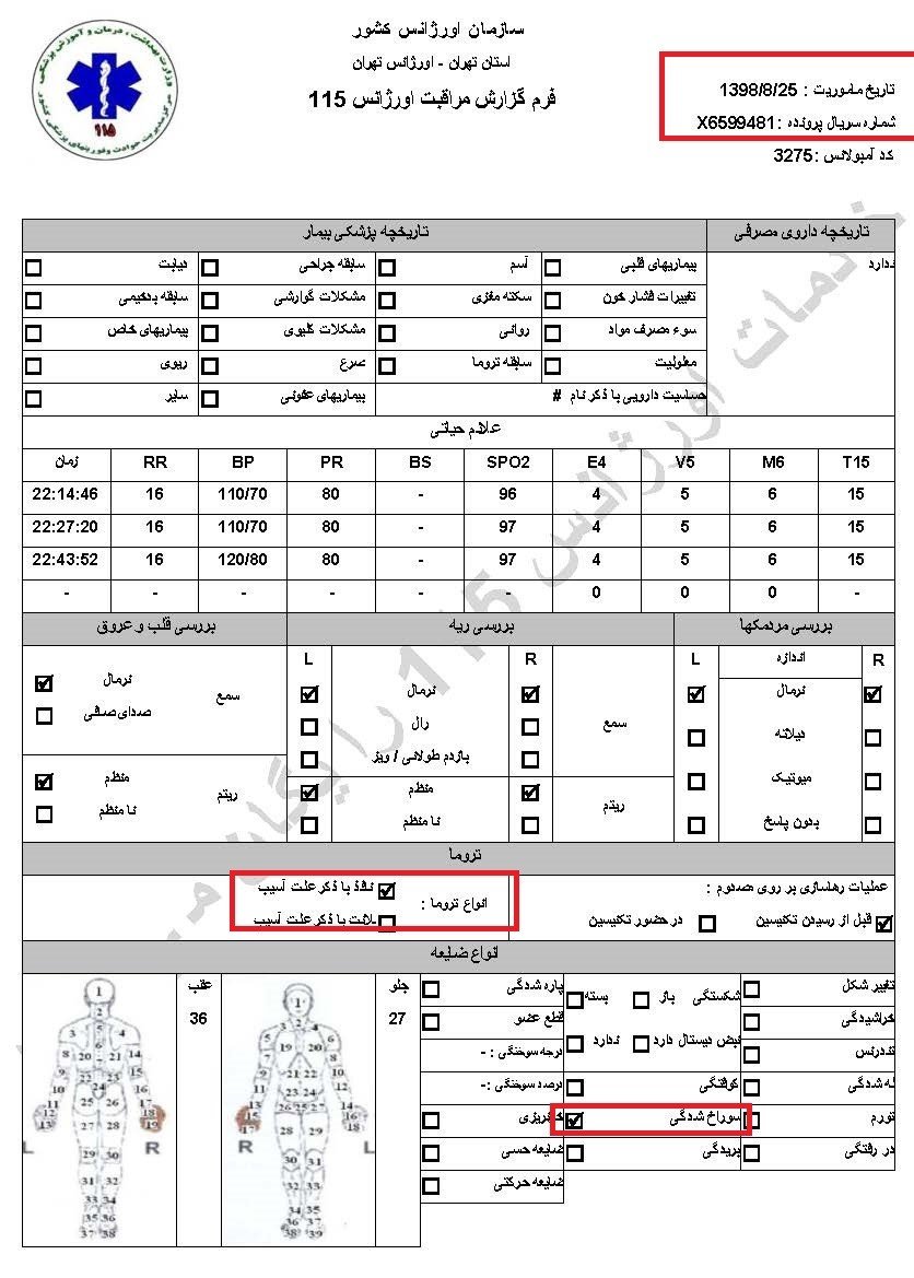 شلیکبه کودکان توسط پاسداران خامنهای وکشتارکور تظاهرکنندگان بیدفاع در آبان۹۸ - اسناد جنایت فاشیسم مذهبی ولایت فقیه