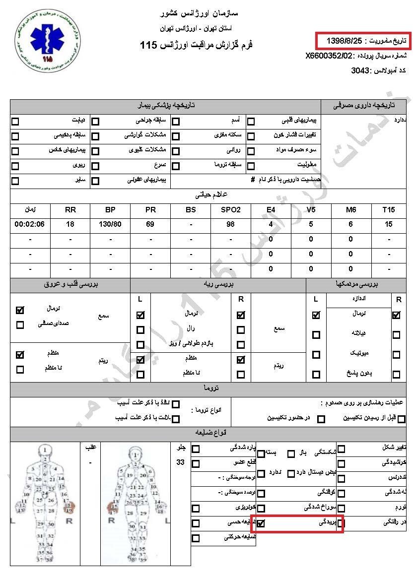 شلیک‌به کودکان توسط پاسداران خامنه‌ای وکشتارکور تظاهرکنندگان بی‌دفاع در آبان۹۸ - اسناد جنایت فاشیسم مذهبی ولایت فقیه